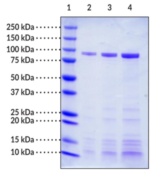 Lane 1: MW Markers<br />Lane 2: Lipoxygenase from Glycine max (soybean) (1 μg)<br />Lane 3: Lipoxygenase from Glycine max (soybean) (2 μg)<br />Lane 4: Lipoxygenase from Glycine max (soybean) (4 μg)
